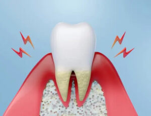 枚方市樟葉の歯医者、たかぎ歯科クリニックで口の中が原因の味覚障害について解説