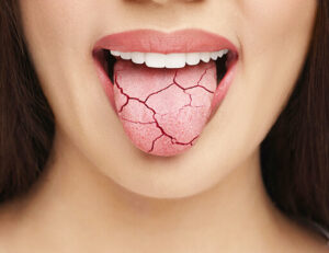 枚方市樟葉の歯医者、たかぎ歯科クリニックで口の中が原因の味覚障害について解説