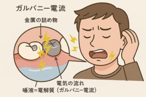 枚方市樟葉の歯医者、たかぎ歯科クリニックで口の中が原因の味覚障害について解説