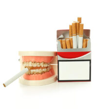 枚方市樟葉の歯医者、たかぎ歯科クリニックでタバコのヤニとりについて解説