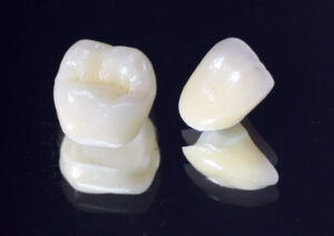 枚方市樟葉の歯医者、たかぎ歯科クリニックで歯と歯茎の間が黒い！ブラックマージンとは？原因と解決法について